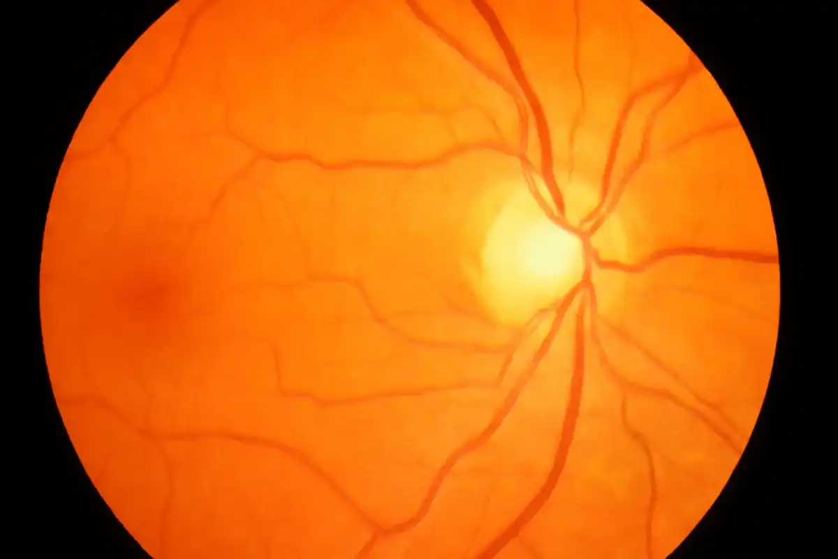 Retinal imaging used during diabetic eye exams in Eagle Mountain, Utah